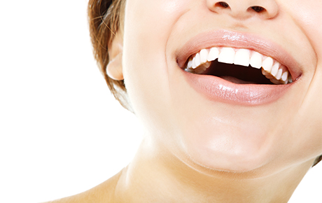 teeth whitening richmond, VA 